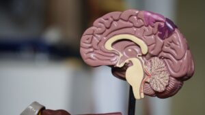 Ressonância magnética mostrando tumor cerebral glioma